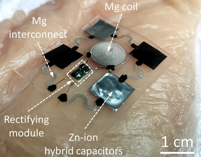 Apró, hajlékony és hatékony ez a bőr alá ültethető töltő-akkumulátor